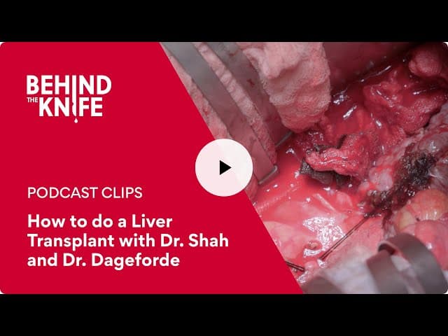 How to do a Liver Transplant with Dr. Shah and Dr. Dageforde