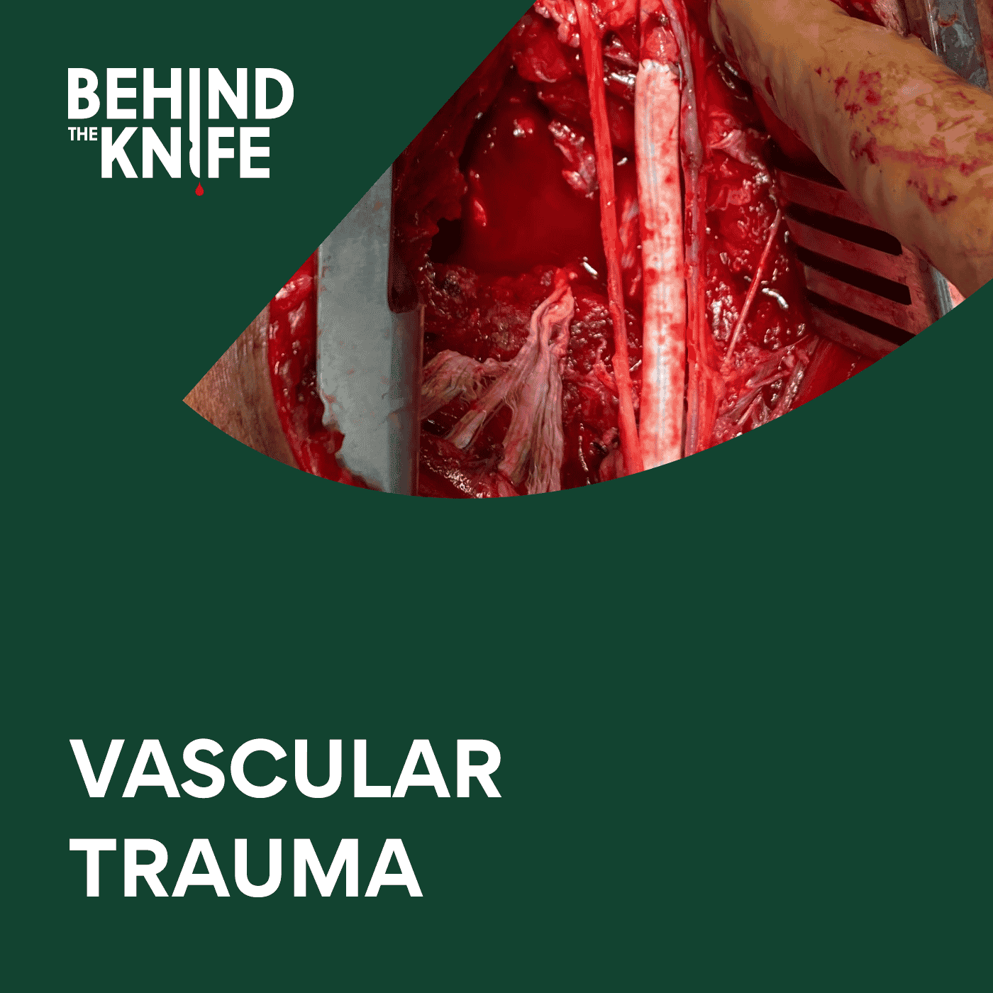 Vascular Trauma