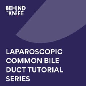 Laparoscopic Common Bile Duct Tutorial Series