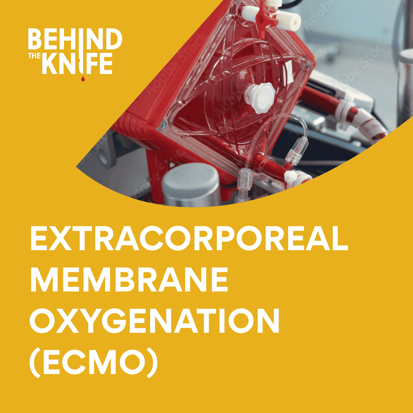 ECMO
