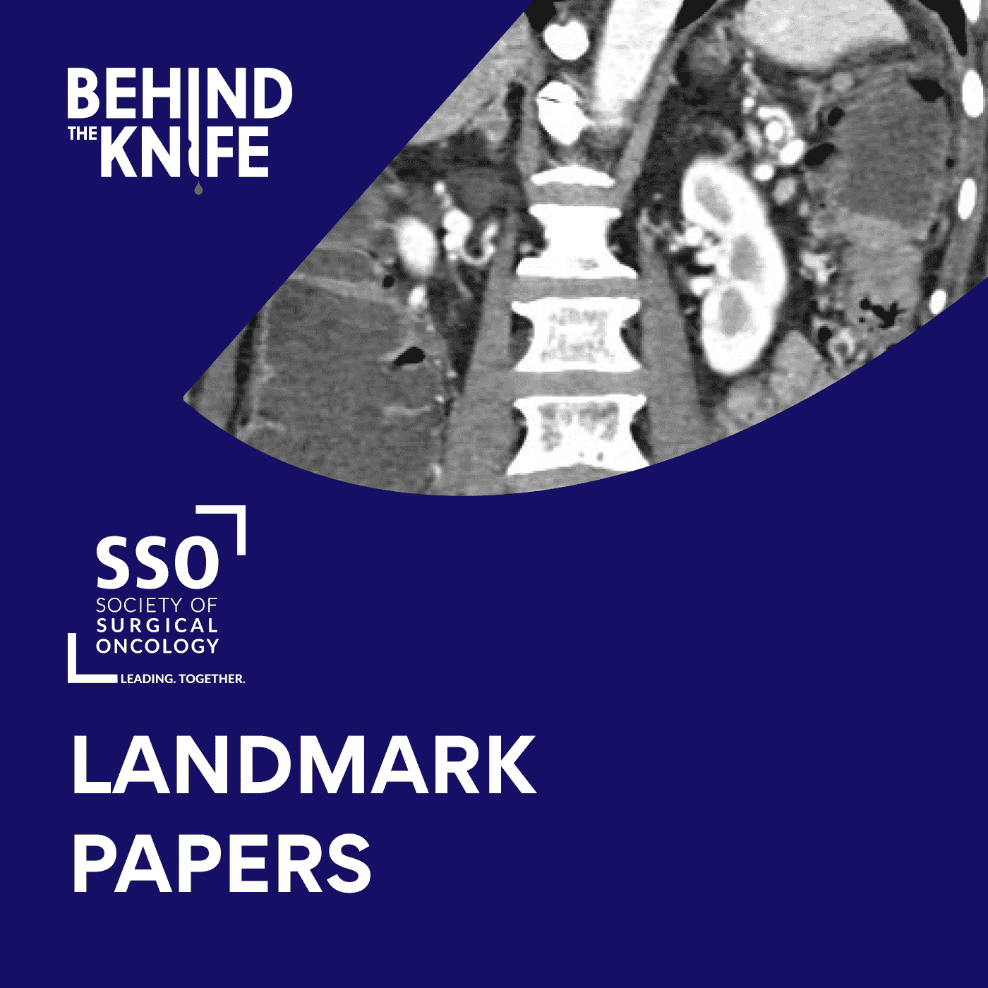 SSO Landmark Papers