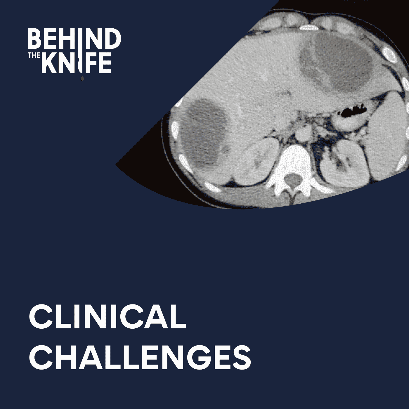 Clinical Challenges