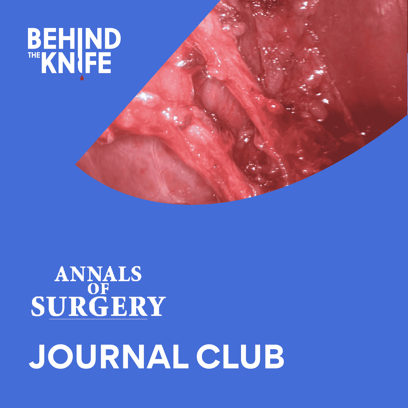 Annals of Surgery Journal Club