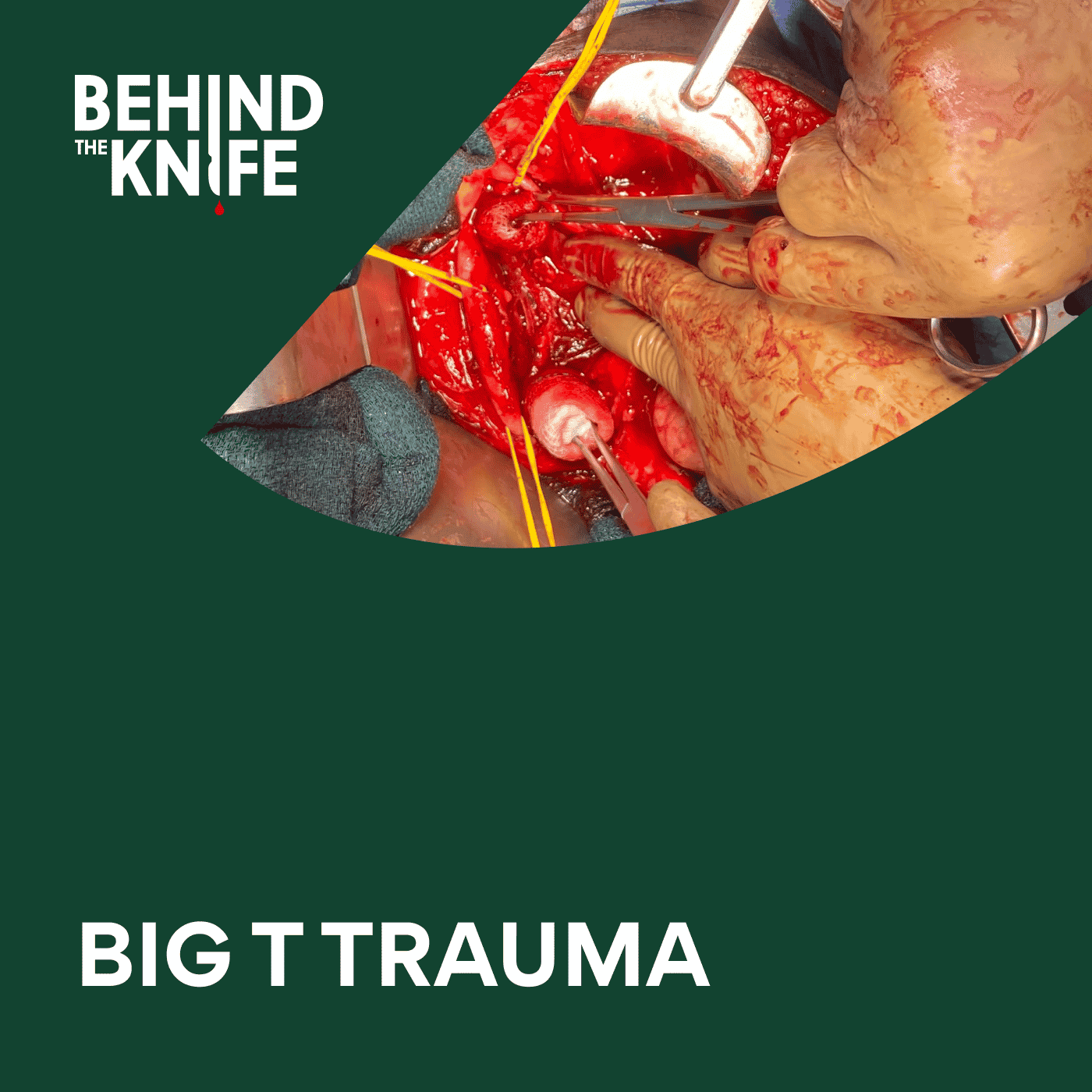 Big T Trauma